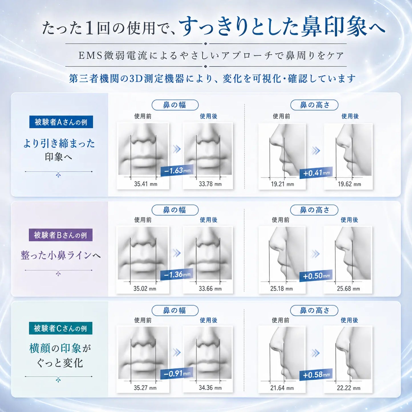 EMS美鼻器 理想の鼻筋へ 鼻専用EMS美顔器 電動ノーズクリップ 美鼻ケア USB充電式 自宅で簡単エステ 男女兼用